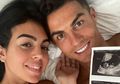 Ini Penyebab Kematian Bayi Mungil Cristiano Ronaldo & Geogrina Rodriguez, Sangat Langka!