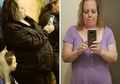 Mengira Tambah Gemuk karena Menopause, Wanita Ini Justru Dapati di dalam Tubuhnya ada Tumor Seberat 22 Kg