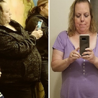 Mengira Tambah Gemuk karena Menopause, Wanita Ini Justru Dapati di dalam Tubuhnya ada Tumor Seberat 22 Kg