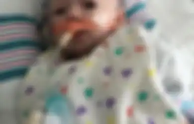‘Tolong Cuci Tangan Sebelum Menyentuh Anakku’, Pesan Seorang Ayah yang Bayinya Nyaris Meninggal Gara-gara Meningitis