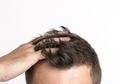 Rambut Sudah Mulai Rontok? 4 Makanan Ini Bisa Jadi Pencegah Kebotakan, Buktikan Khasiatnya!