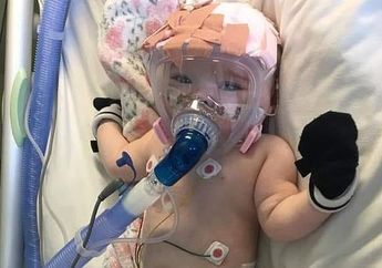 Bayi 6 Bulan dengan Kelainan Jantung Ini Berhasil Kalahkan Virus Corona, Saat Dia Sembuh Suasana Haru di Rumah Sakit pun Tercipta