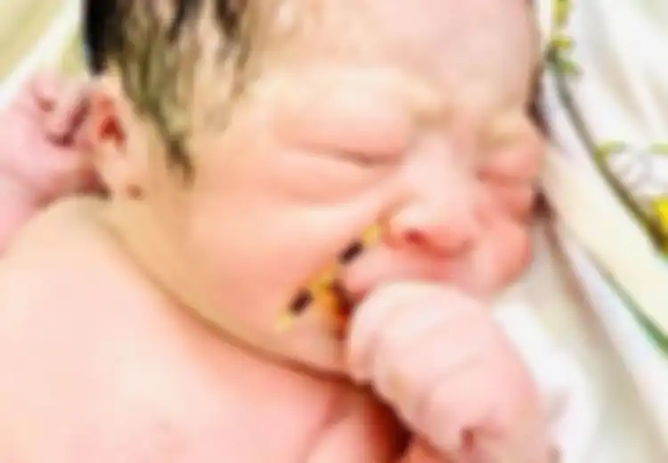 Menilik Kasus Heboh Bayi Lahir dengan Memegang Alat KB Spiral Milik Ibunya, Benarkah Alat KB Spiral Tak Efektif?