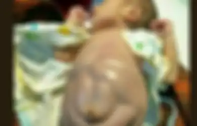 Perut Bayi 4 Bulan Ini Membesar Setelah Diberi Makan Nasi, Ini Risiko Beri Makan Bayi Selain ASI Sebelum 6 Bulan