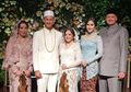 Adik Ipar Tasya Kamila Tunangan, Begini Cantiknya Adik Randi Bachtiar di Hari Spesialnya
