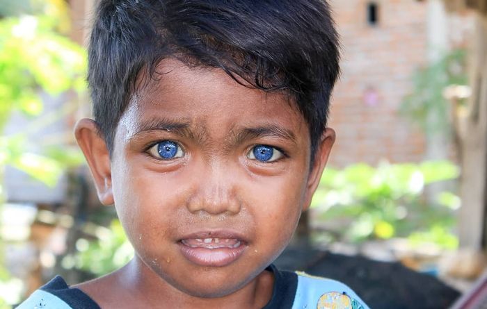 Bukan Karena Keturunan Eropa Mata Biru Suku Buton Ternyata Karena Sindrom Waardenburg Sudah Turun Temurun Dari Nenek Moyang Semua Halaman Hits