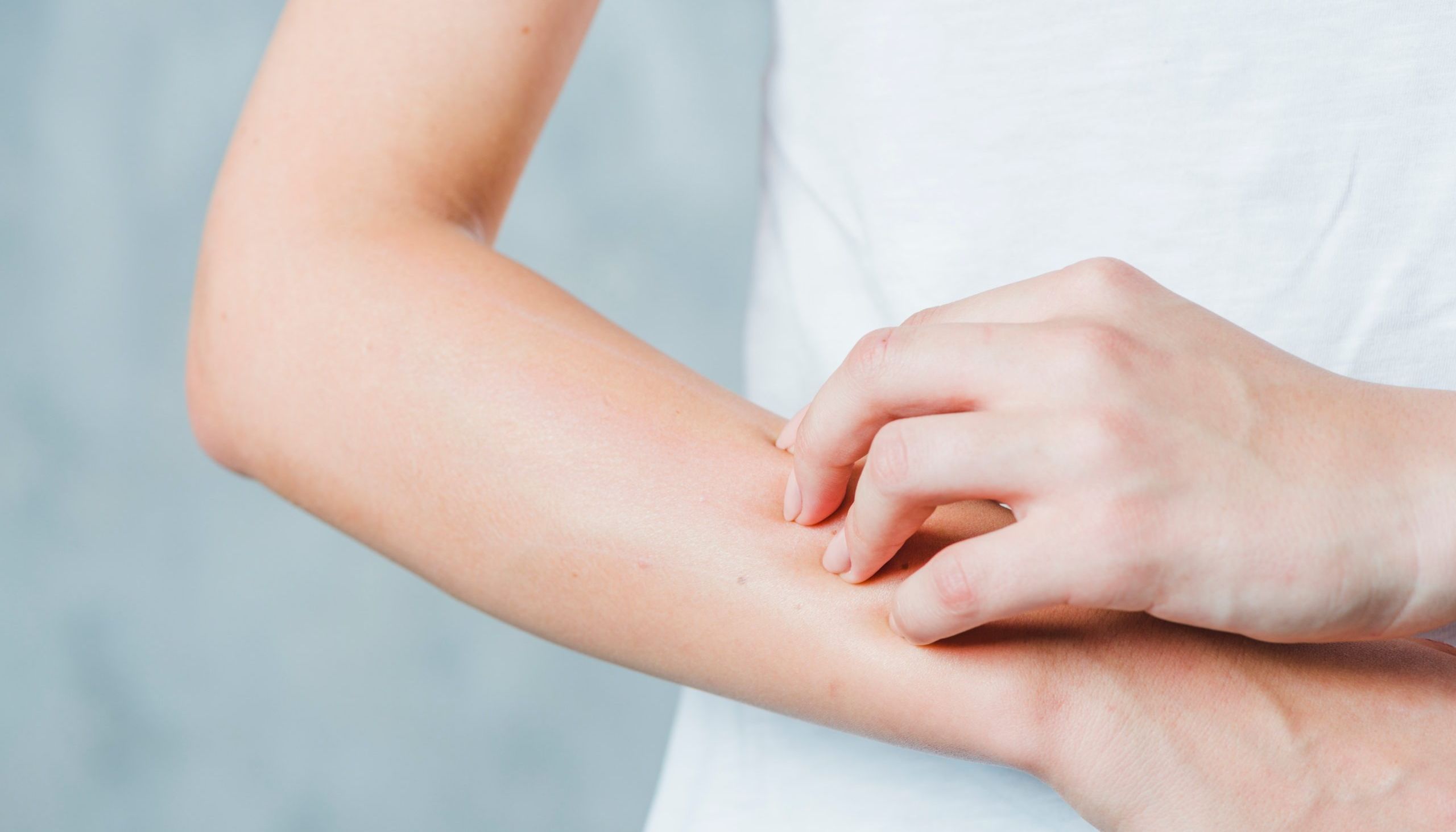 Псориазный гиперкератоз. Аллергическая сыпь на локтях. Сухие локти у ребенка причины. Сухие локти у ребенка причины. Сухие локти у ребенка причины.