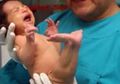 Terlahir Seperti Putri Duyung, Dokter Memvonisnya Segera Meninggal, Tapi 7 Tahun Kemudian Kondisinya Mengejutkan Banyak Orang