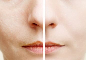 4 Serum 200 Ribuan yang Efektif Banget Mengecilkan Pori-Pori. Wajib Punya!