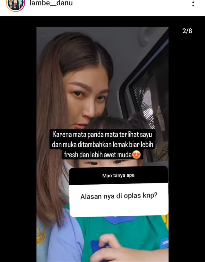Sarwendah ungkap alasan oplas