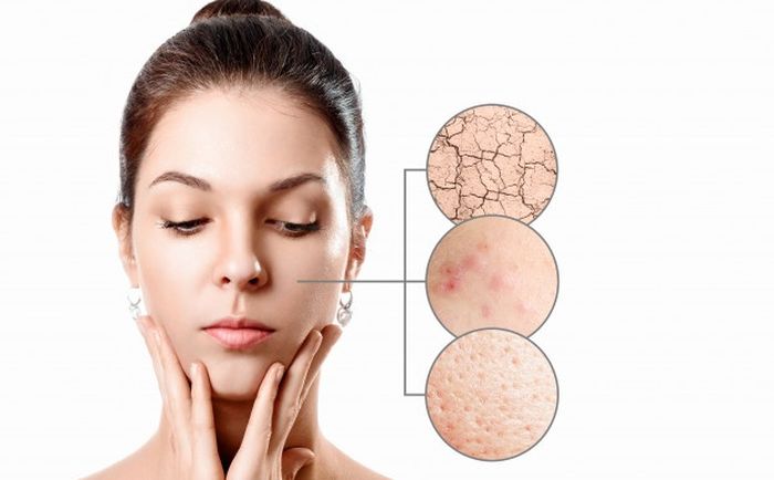 Tanda-tanda produk skincare yang kamu gunakan tidak cocok lagi #DiRumahAjaBisaCantik.