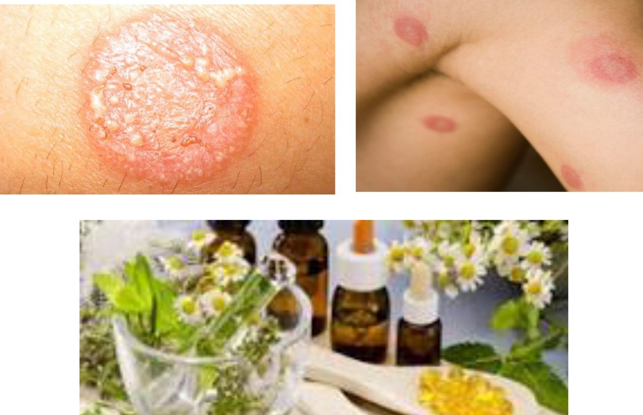 This is a for Ringworm Medicine from Efficacious Natural