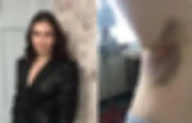 Muncul Banyak Memar Misterius di Tubuhnya, Wanita Ini Meninggal Seminggu Setelah Temui Dokter, Tak Disangka Ada Penyakit Mematikan Ini