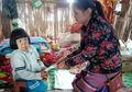 Alami Kelainan Genetika, Gadis 9 Tahun Ini Punya Wajah Seperti Nenek-nenek 60 Tahun