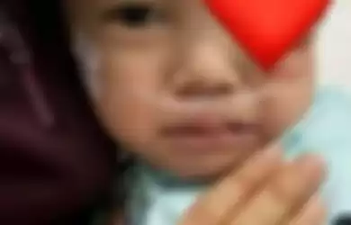 Foto anak Vanessa Angel, Gala Sky Andriansyah yang terluka tersebar luas di media sosial.