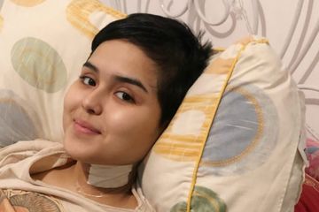 Kelumpuhan Cervical Vertebrae Dislocation yang Dialami Laura Anna, Inikah Penyebab Kematiannya?