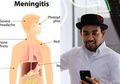Penularan Meningitis yang Mesti Diwaspadai, Infeksi Yang Dialami Glenn Fredly