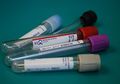 1 Dari 10 Orang Indonesia Idap Hepatitis B, Dokter Ahli Penyakit Dalam Ingatkan Segera Obati Sebelum Kronis!