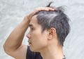 Masih Muda Tapi Rambut Sudah Putih? Jangan Panik, Ini Hal Mudah yang Terbukti Bisa Menghilangkan Uban