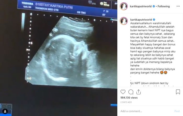 Kartika Putri pamer hasil usg