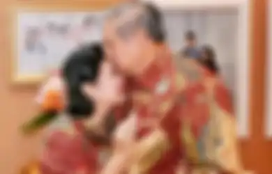 Ani Yudhoyono Terkena Kanker Darah: Ini 5 Gejala Leukemia yang Sering Diabaikan, Salah Satunya Memar