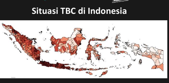 TBC di Indonesia
