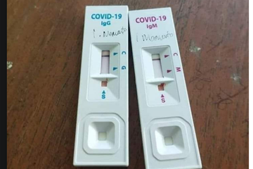 Benarkah Anak di Bawah 12 Tahun Perlu Rapid Test Antigen Saat Bepergian? Ini Aturan Satgas Covid-19