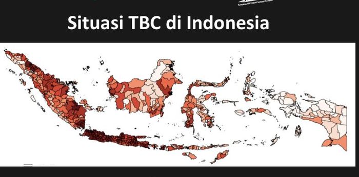 TBC di Indonesia