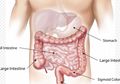 Kesehatan Usus pun Perlu Diperhatikan, Yuk Bersihkan Usus Anda dengan 6 Cara Alami Berikut!