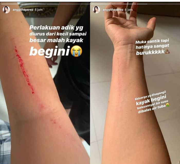 Perseteruan Anggia Perez dan Della Perez