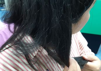 Cara Menumbuhkan Rambut Pitak, Rambut Auto Lebat Bikin Kaget