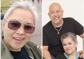 Tak Pernah Merokok Namun Terkena Kanker Paru-Paru, Inilah 3 Penyebab Istri Indro Warkop Meninggal Dunia