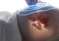 Ingin Mencoba USG 4 Dimensi, Ini Waktu yang Tepat Melihat Betapa Lucunya Calon Bayi