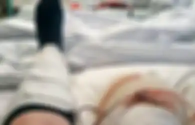 Hanya Karena Kejatuhan Botol Parfum, Wanita Ini Minta Kakinya Diamputasi, Ini Alasannya