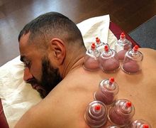 Terapi Bekam Jadi Solusi Karim Benzema Pulihkan Kebugaran Fisik