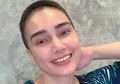 Feby Febiola Alami Kerontokan selama Kemo, Ternyata Ini Penyebab Rambut Mudah Rontok saat Kemoterapi