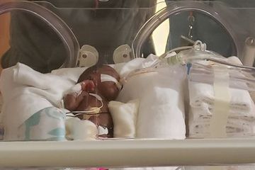 Keberhasilan bayi prematur dalam bertahan hidup perlu didukung oleh berbagai hal mulai dari dokter, perawat, alat, orangtua.
