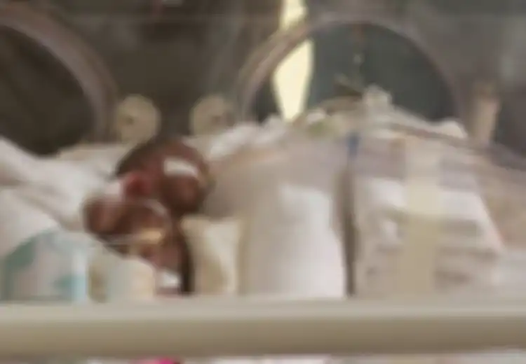 Tangannya saat Dipasangi Cincin Kejutkan Banyak Orang, Bayi Prematur Ini Benar-benar Lahir dengan Tubuh Sangat Kecil, Kurang dari Setengah Kilogram