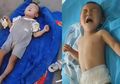 Miris, Bayi yang Derita Cacat Ini Dibuang Orang Tuanya di Pinggir Jalan Hanya dengan Selimut dan Botol Susu