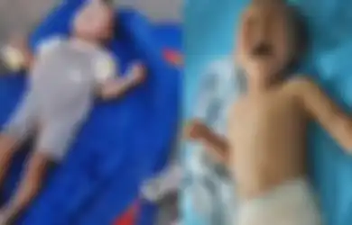 Miris, Bayi yang Derita Cacat Ini Dibuang Orang Tuanya di Pinggir Jalan Hanya dengan Selimut dan Botol Susu