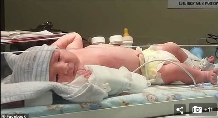 Bayi malang ini tewas katena popoknya tak diganti selama 14 hari.