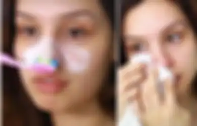 Berbekal Sikat Gigi dan Odol, Begini Cara Hilangkan Komedo pada Hidung dengan Cepat