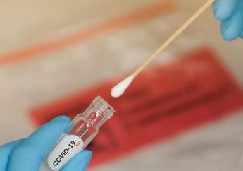 Hasil Rapid Test Antigen Jadi Syarat Lakukan Perjalanan Darat di Jawa dan Bali, Ini Aturan Kemenhub