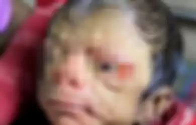 Baru dilahirkan, wajah bayi ini malah buat seisi ruang operasi terdiam