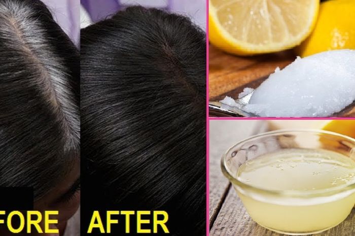 Oleskan Campuran Minyak Kelapa Dan Lemon Pada Rambut Lihat Hasilnya Semua Halaman Nakita