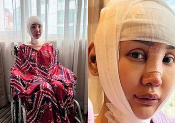 'Tembolokku dibolongin,' Belum Puas Potong Leher dan Tulang Ekor, Lucinta Luna Berencana Lakukan Satu Kali Operasi Lagi
