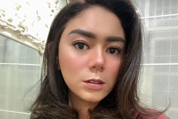 Kondisi Thalita Latief usai operasi pengangkatan tumor tiroid