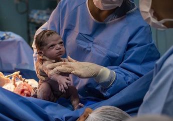Bayi Terlahir dengan Tampang 'Marah', Tak Mau Menangis dan Terus Cemberut Meski Telah Dibujuk Dokter, Simak Kisahnya!