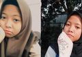 Sempat Kritis dan Hampir Meninggal, Begini Ungkapan Haru Nabila Gadis Kembar yang Dipertemukan dengan Saudaranya Setelah 16 Tahun untuk Orang Tuanya