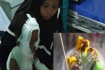 Ahsan, bocah TK yang menjadi korban dari jajanan es asap atau smooky snack, inilah bahaya makanan bernitrogen lainnya.
